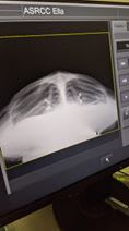 X-ray of Ella the green sea turtle